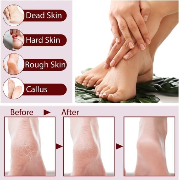Callus Remover - Image 5